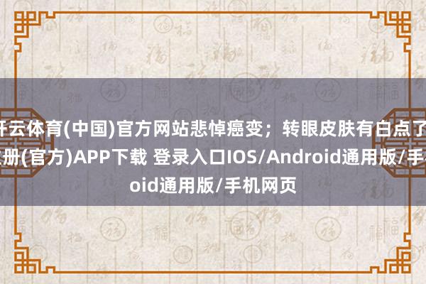 开云体育(中国)官方网站悲悼癌变；转眼皮肤有白点了-开云注册(官方)APP下载 登录入口IOS/Android通用版/手机网页